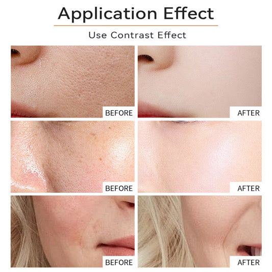 TURMERIC + VITAMIN C SKIN CARE Anti  Acne Dark Spot SET 7pcs. Facial scrub,Gel cleanser,Clay mask, Toner,Serum,Facial oil